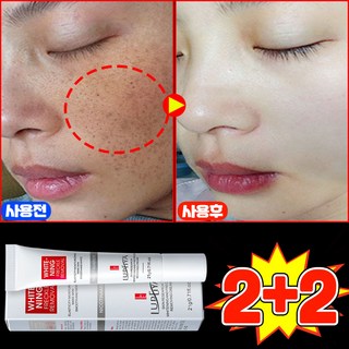 [100% 효과있음] 멜라논 크림 기미크림 기미 잡티 주근깨 검버섯 제거 크림 착색 미백 크림 들깨기미크림 색소침착 화이트닝 LUPEIYA 포장증정, 4개, 21g