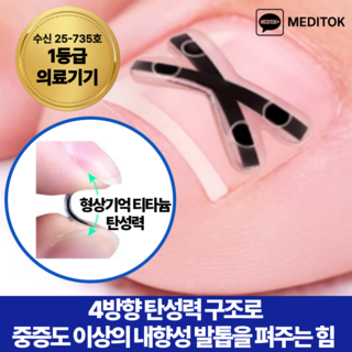 메디톡 티탄토우 더블 티타늄 밴드 교정기 X자형 내성발톱 교정기 교정밴드 티타늄 의료기기 테이프 파고드는 발톱 관리 교정팁, 10개