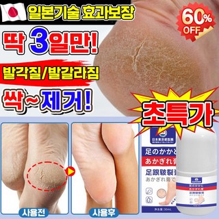 [고보습] 일본기술 1/1+1/2+2 풋크림 발각질제거 크림 풋케어 스틱 발크림 발뒤꿈치 굳은살 제거 발갈라짐 크림, 30ml, 1개, 1개입