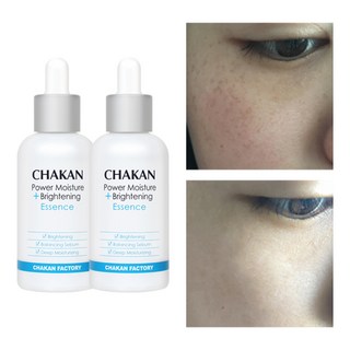 기미 잡티 주근깨 미백 색소침착 착색 검버섯 수분 보습 화이트닝 광채 기미잡티 에센스, 2개, 50ml