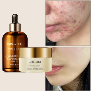 로리앤첼 글로리어스 수분 보습 크림 & 에센스 세트, 크림+에센스, 1세트