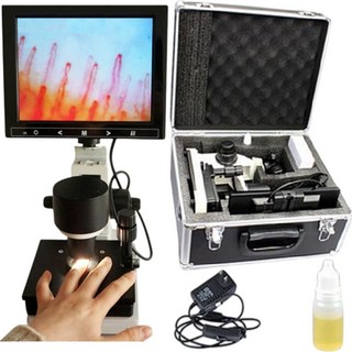 高清8吋手指微循環顯微鏡 電子顯微鏡 末梢血管觀察儀 血管顯像儀 工具顯微鏡 放大鏡, 1個, 8吋螢幕手指微循環顯微鏡, 600