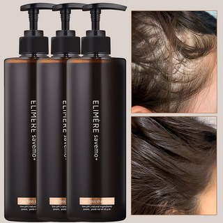 탈모 임상완료 샴푸