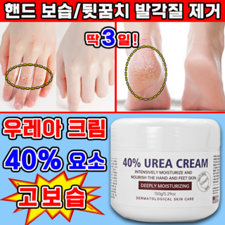 유리아 크림 우레아 풋크림 함익병 유레아 크림 뒷꿈치 피부연화제 유리아크림 발 각질제거 고보습 풋크림 사은품 증정, 149g, 1개, 1개입