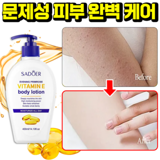 고보습 바디로션 우레온 모이스처 리페어 바디로션 보습지속 남자 여자 바디로션, 4개, 400ml