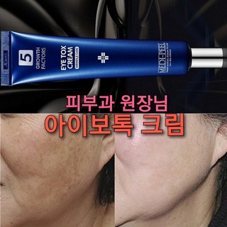 기미 검버섯 앰플/아이보톡 다크서클제로, 5.@아이보톡싱 크림 2개, 1개, 30ml