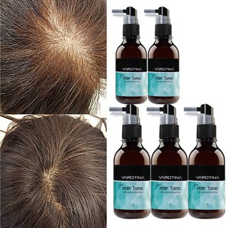 바로티나 뉴헤어토닉 정수리 M자 탈모 고민 끝 탈모 증상 완화 기능성 두피 토너 앰플, 100ml, 5개