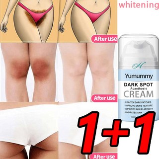 1+1멜라닌 제거 미백 크림 겨드랑이 표백 엉덩이 무릎 미백 스킨 케어 겨드랑이 착색 사타구니 착색 팔꿈치 착색 미백 바디미백 엉덩이, 2개, 50ml