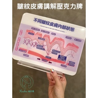 皺紋皮膚壓克力講解壓克力立牌/醫學美容/皮膚講解牌，清晰展示皮膚結構，提升醫美諮詢專業度, 1個