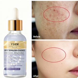 [기미 잡티 제거 크림1위] 기미 검버섯크림 1 여성 멜라토닝크림 고보습 영양크림 미백크림 기미크림 위앰플기미 병풀 기미 고혼진 크림 기미 잡티 미백 잡티 주근깨 검버섯 버섯 흑자, 30g, 1개