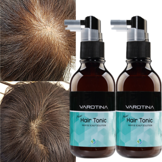 바로티나 뉴헤어토닉 2개 + 헤어볼륨S 홈케어 탈모관리 탈모토닉 여성 탈모 토닉 남성 탈모 토닉 두피에센스, 100ml