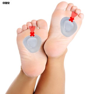 지간신경종 앞꿈치 패드 이미지