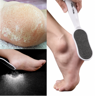 역대급커먼스 풋파일 각질제거기, 1개, 1개입