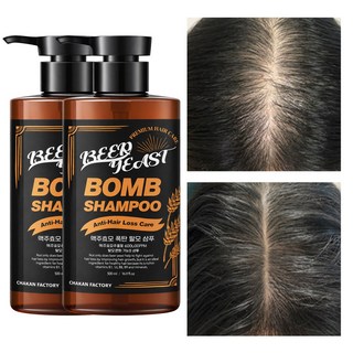 탈모샴푸 약산성 두피 맥주효모 탈모 완화 비오틴 바이오틴 남자 여자 샴푸 볼륨, 2개, 500ml