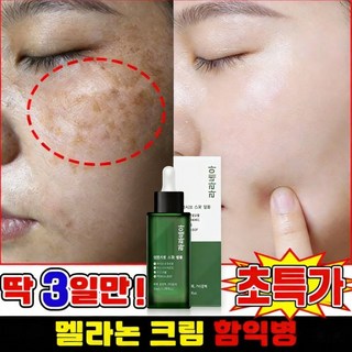 [여성 고보습 영양크림] 기미 잡티 제거 크림1위 기미크림 미백크림 / 미백 세럼 / 여드름 흉터/잡티 제거 / 주근깨 완화 / 니아신아마이드+알부틴+트랜엑산산, 1개, 50g