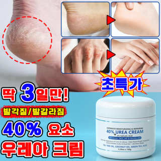 [고보습] 풋크림 발각질제거 함익병 유레아 크림 100% 우레아 크림 뒷꿈치 유리아 요소 크림 발뒤꿈치 각질제거 보습크림, 150g, 1개, 1개입