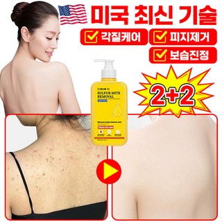 [효과보장]1/1+1 유황 바디워시100% 유황 바디워시 데일리 딥클렌징 샤워 물비누 향균 여드름 등드름 가려움증 개선 완화 피지감소 각질제거 고농축 목욕 입욕제, 4개, 300ml