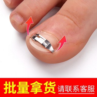 내성발톱 자가 개선 내향성 키트 세트 교정기 네일 그루브 코렉터 인레이 버클 발톱, L