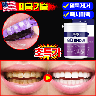 [치과추천1위] 퍼플 가루 치약 치아 관리 파우더 화이트닝 누렁니 미백 조색 흡연 커피 착색 클리닝 치석 얼룩 제거, 1개