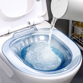 ErrifY 가정용 좌욕기 치질 변비 케어, 투명블루, 1개