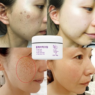 멜라논 크림 함익병 들깨 미백크림 멜라논 크림 함익병 미백크림 함익병 멜라논 크림 미백연고 기미 잡티 제거 크림 기미 잡티 검버섯 흑자 제거크림 화사한피부