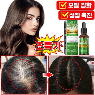 [빠른배송] 로즈마리 오일 100% 탈모 두피 앰플 영양제 두피에센스 탈모 예방 머리 성장 촉진 모발 활력 증진 모낭 영양 포장 증정, 1개, 30ml