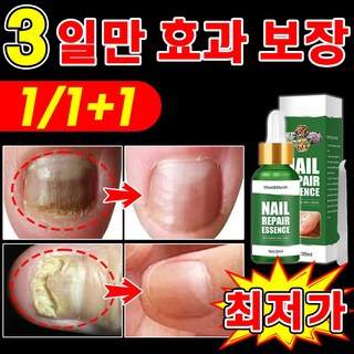 [네일케어] 발톱 거품나는앰플 솔루션 문제성발톱 앰플 발톱 곰팡이 한번에끝내는 손발톱 영양제 보장증정, 1개, 30ml