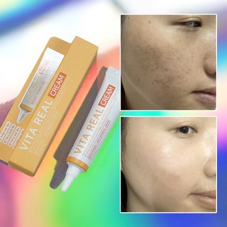 1+1 기미 잡티 비타민 피부과 재생 레이저후 점뺀후 미백 탄력 영양 보습 수분 크림, 15ml, 1세트