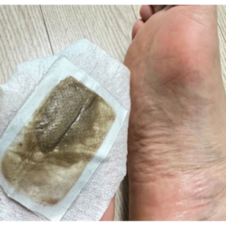 종아리근육뭉침파스 발바닥열감 족저근막염파스 발독소 발바닥파스 발패치 발파스, 10개, 릴렉스