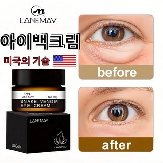 아이백크림 아이백리프트 눈밑지방제거 눈밑주름 아이백크림, 30g, 3개