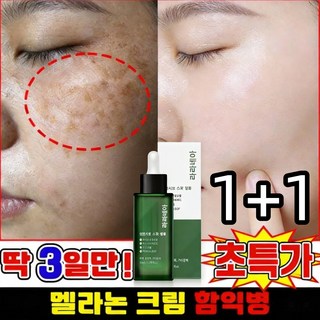 [여성 고보습 영양크림] 기미 잡티 제거 크림1위 기미크림 미백크림 / 미백 세럼 / 여드름 흉터/잡티 제거 / 주근깨 완화 / 니아신아마이드+알부틴+트랜엑산산, 2개, 50g