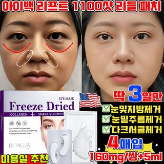 아이백 리프트 1100샷 리들 패치 눈밑 지방제거 패치 눈 밑 아이패치 니들 패치 눈밑주름 다크서클 눈밑꺼짐 개선 리프팅 패치 동결건조 아이백 사은품 랜덤 증정, 1개, 4개입