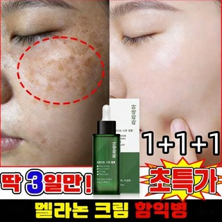 [여성 고보습 영양크림] 기미 잡티 제거 크림1위 기미크림 미백크림 / 미백 세럼 / 여드름 흉터/잡티 제거 / 주근깨 완화 / 니아신아마이드+알부틴+트랜엑산산, 3개, 50g