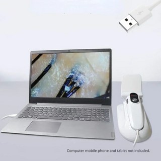 USB 피부 머리 감지기 모낭 안료 돋보기 분석기 테스터 안드로이드 Windows 50X, 한개옵션0
