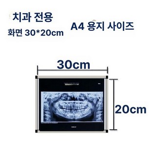 x-ray 검사 병원 ct 보드 치과 조명판 led 정형외과 필름 판독기 건강검진복, 기본 색상, 1개
