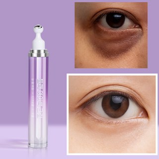 눈밑 지방제거 아이 크림 콜라겐 레티놀 1% 파워 리프팅 아이크림 눈 밑 지방 제거 크림 눈밑지방재배치 아이케어 아이백 크림 다크서클 개선 다크서클 제거 크림 눈가 주름 탄력 개선, 1개, 20ml