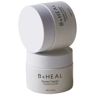 트라넥삼산 4% 색소침착 잡티 멜라토닝 기미 미백 크림, 2개, 50ml