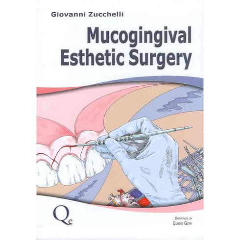 Mucogingival Esthetic Surgery, Quintessence Pub Co