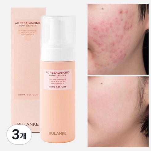 불란케 에이씨 리밸런싱 여드름 기능성 청소년 약산성 폼클렌징, 3개, 150ml