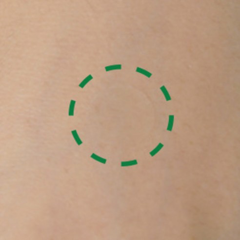 큐어시스 어성초 아크페어 스팟패치 이미지 3