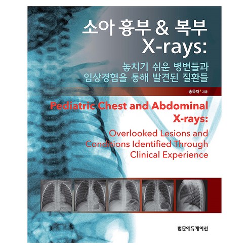 소아 흉부 복부 X-rays 놓치기 쉬운 병변들과 임상경험을 통해 발견된 질환들, 양장