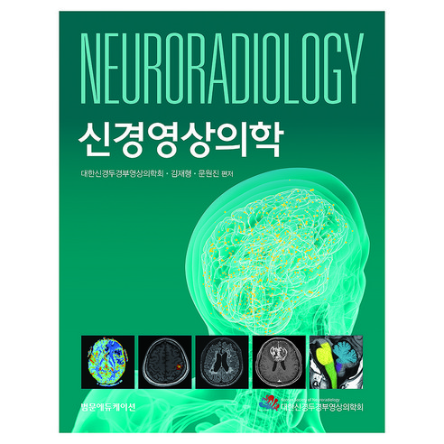 신경영상의학, 양장