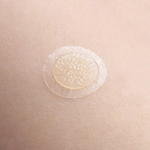 듀오덤 스팟패치로 갑작스러운 피부 트러블 걱정 없이 자신감 있는 하루를