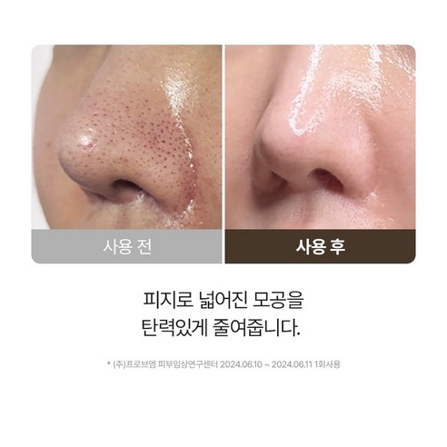 마미케어 감자 워시 오프 팩 100g 솔직 후기 | 실사용자 리뷰 분석 - 상품 이미지 4