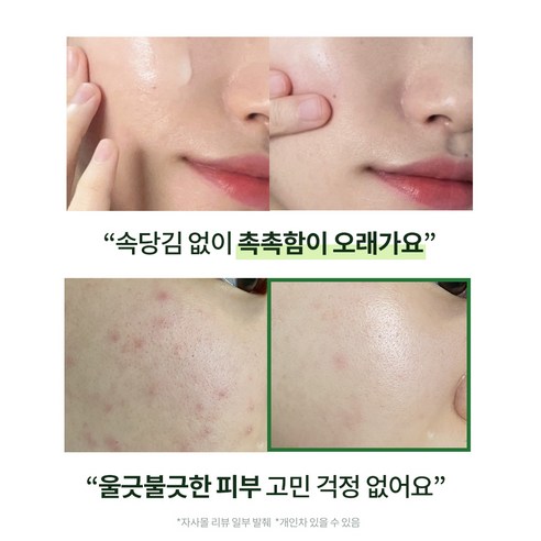 밀크터치 서양송악진정크림 (튜브) 이미지 4