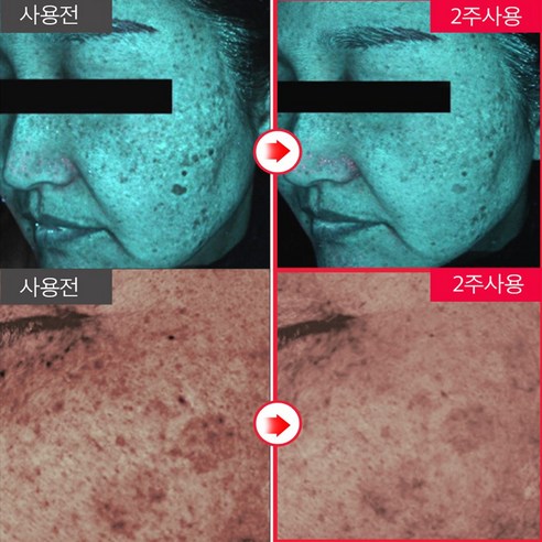 콜라겐 미스트 안개 분사 수분 미스트 콜라겐88% face mist 이미지 2