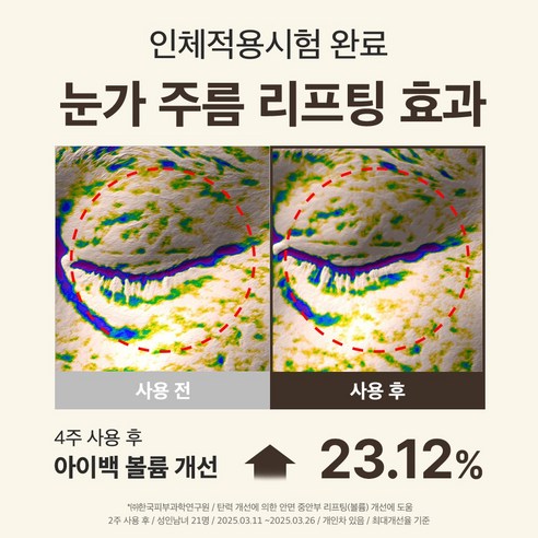 성분에디터 녹는실 실크 펩타이드 인텐시브 리프팅 아이크림 대용량 솔직 후기 | 피부 타입별 분석 - 상품 이미지 3