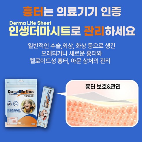 의료기기 인생더마 시카케어 흉터밴드 피부재생 흉터패치 화상 제왕절개흉터 실사용 후기 | 효과 있을까? - 상품 이미지 3