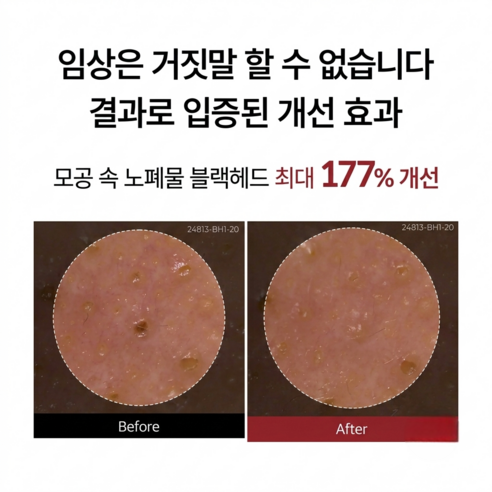 닥터멜락신 필 샷 각질 케어 쌀 앰플 고마쥬 필링 젤 흑미 이미지 3