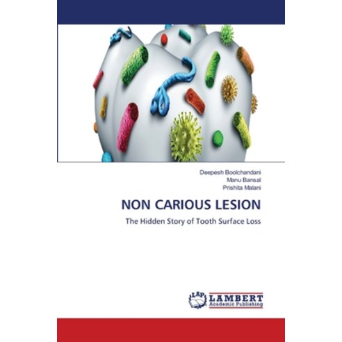 (영문도서)Non Carious Lesion Paperback, LAP Lambert Academic Publis..., English, 9786209611858
